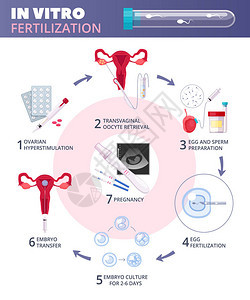 带有从卵巢动脉刺激到怀孕矢量插图等步骤的有色平板体外受试管受精I图片
