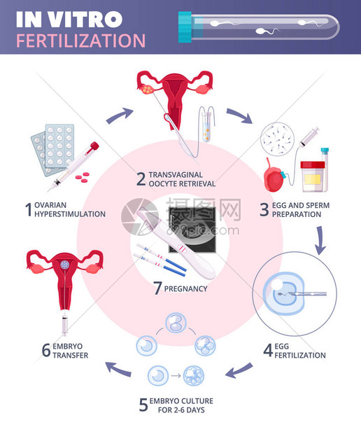 带有从卵巢动脉刺激到怀孕矢量插图等步骤的有色平板体外受试管受精I图片