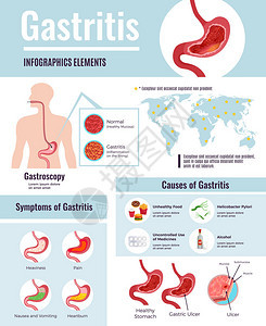 胃炎图表海报图片