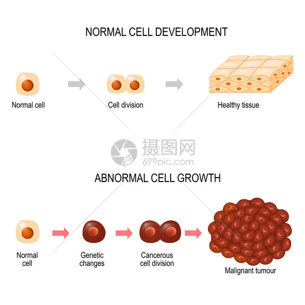 癌细胞插图显示癌症疾病的发展健康组织和恶肿瘤用于您的设计教育生物科学和图片