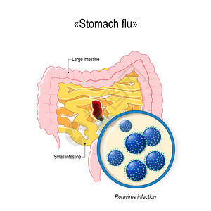 轮状感染或肠胃流感小肠结肠和轮状粒子的特写人体解剖学用于您的设计教育生物科学和医疗图片