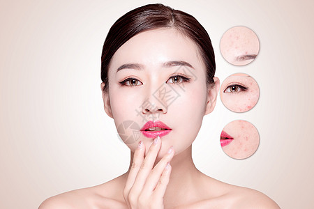 粉刺治疗痤疮疤痕概念设计图片