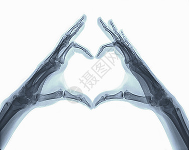 爱心形状的X射线图像图片