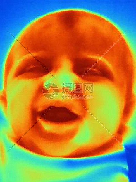 三个月大婴儿的热成像图片