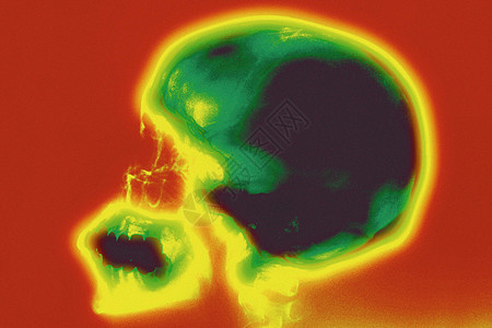 脑部扫描图图片