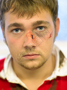 脑干出血伤痕累累的橄榄球运动员背景