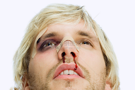 面部受伤的男人图片