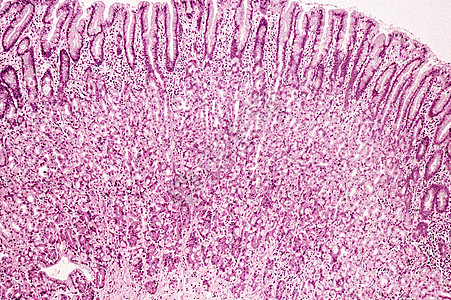 胃粘膜图片