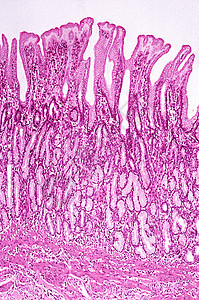 幽门粘膜图片