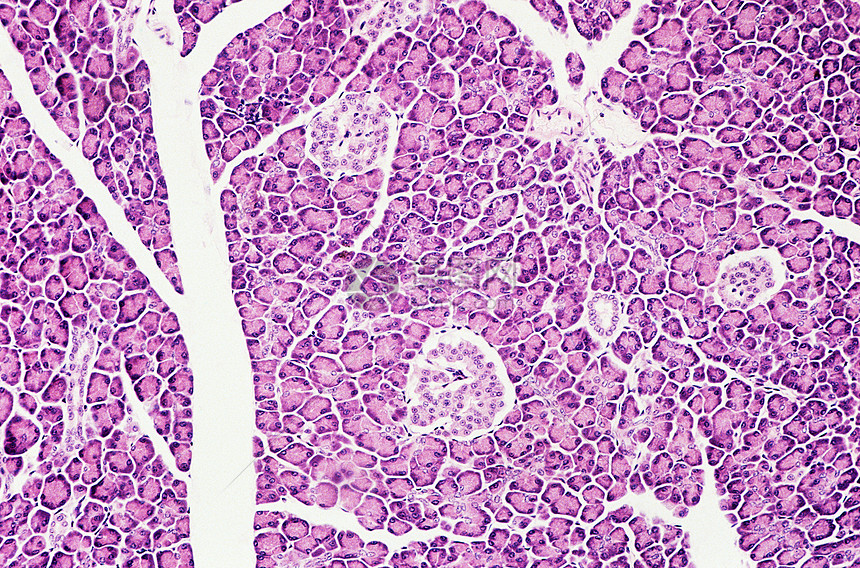 胰腺泡心细胞图片图片