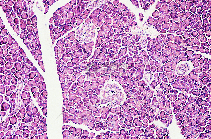 胰腺腺泡细胞图片