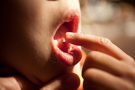 女孩用食指触碰松动的牙齿图片