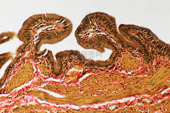 显微镜下的胆囊粘膜图片
