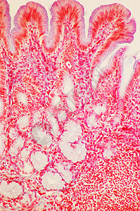 显微镜下的胃幽门区背景图片