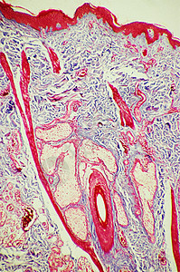 显微镜下的皮肤毛囊背景图片