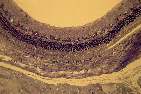 视网膜图片