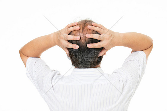 中年男人秃头危机图片