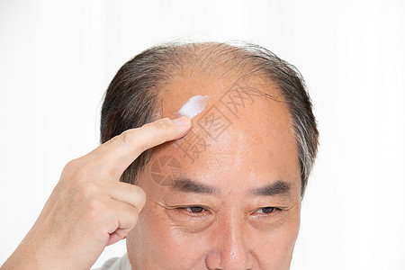 秃头中年男性用增发膏图片