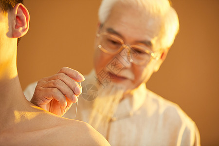 背部养生老中医给病人肩部针灸按摩背景