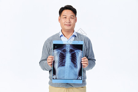 中年男性体检手拿x光片点赞图片