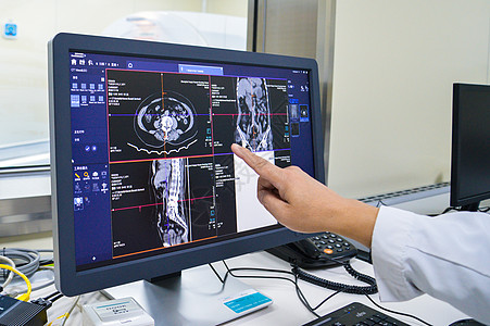 医疗ct监控图片