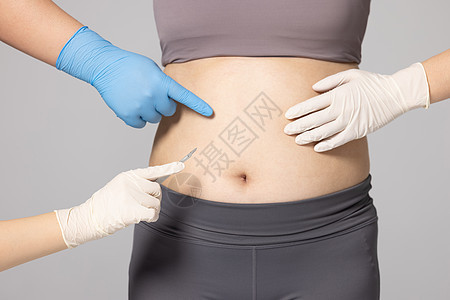 女性肚子脂肪瘦身手术特写图片
