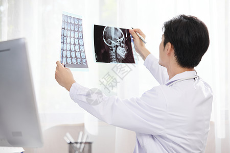 x光照片诊室里拿着x光片比对的医生背景
