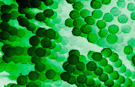 电子显微镜Aspergillus共产体图片