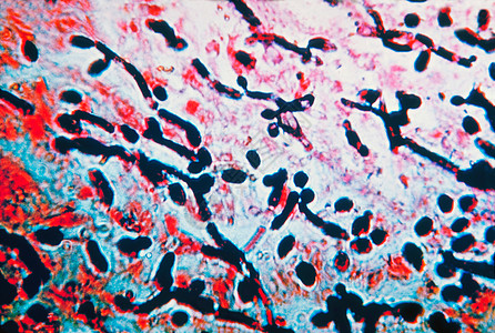 食道肌肉中Candida显微摄影图背景图片