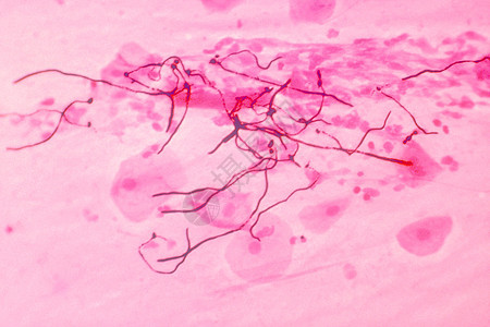 光镜照片肺组织中的白色念珠菌图片