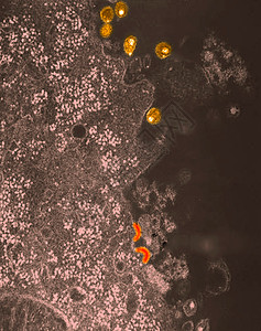 艾滋病毒电子显微图图片