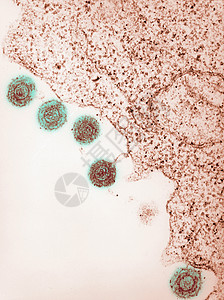 HHV6型人类疹6HHV电子显微图图片