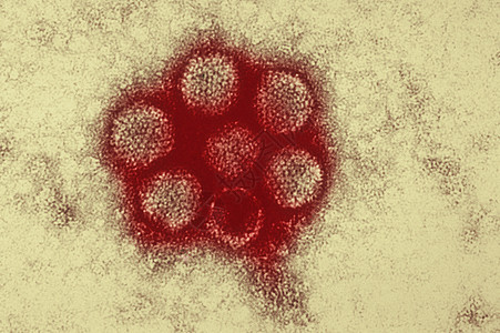 菊糖显微图图片