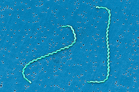 扫描电子显微镜下的Leptospira细菌图片