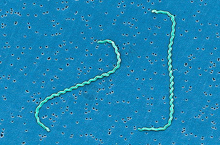 扫描电子显微镜下的Leptospira细菌图片
