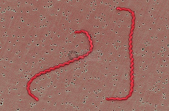 扫描电子显微镜下Leptospira细菌图片