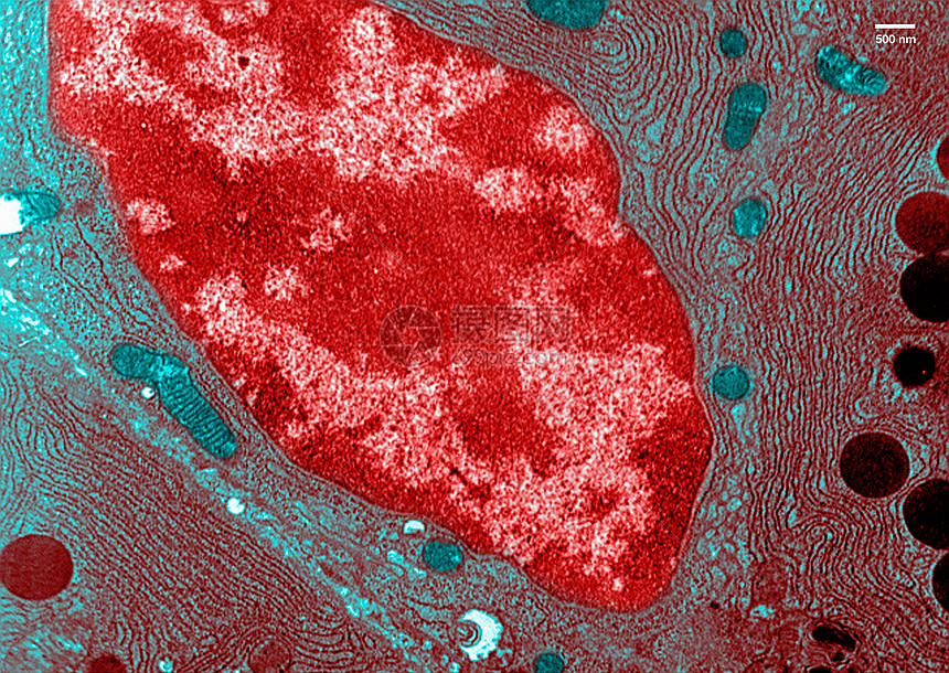 胰腺透射电镜照片