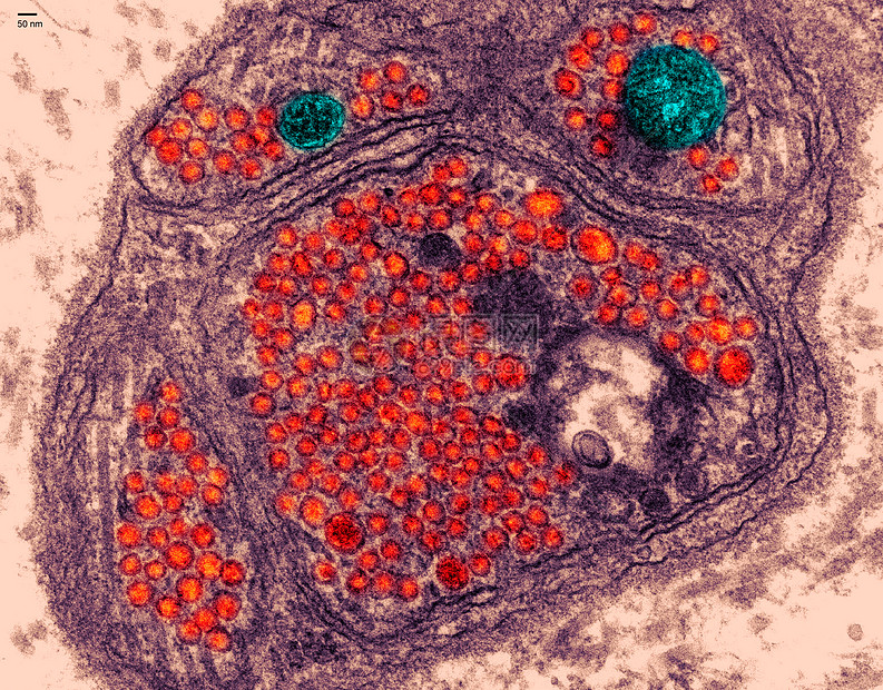 胰腺透射电镜照片