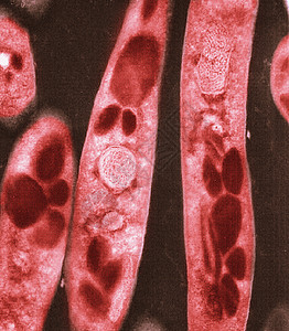 炭疽杆菌电子显微图图片