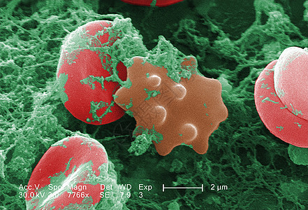红血细胞SEM图片