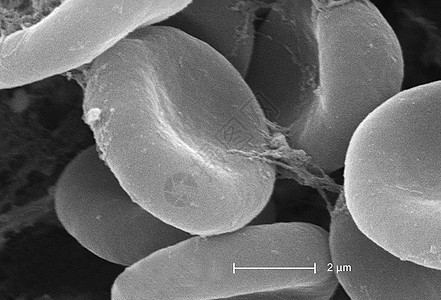 显示红细胞和纤维蛋白的扫描电镜图片