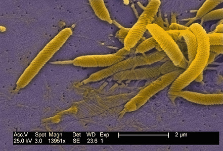 长鳍龙细菌的SEM图片