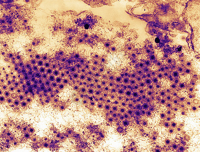 呼肠孤病毒3型透射电镜图图片