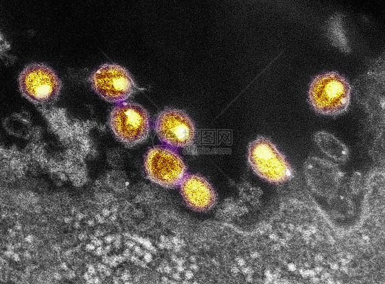 艾滋的透射电镜图片