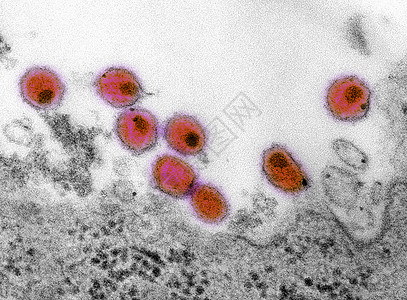 艾滋的透射电镜图片