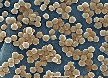 MRSA的SEM抗甲西林的药吸血球菌图片