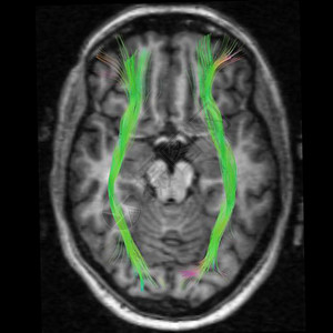 医学磁共振成像图片