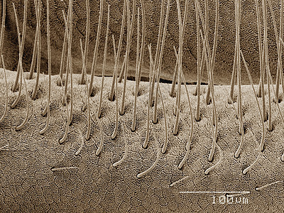 沙蝇触角的彩色扫描电镜图片