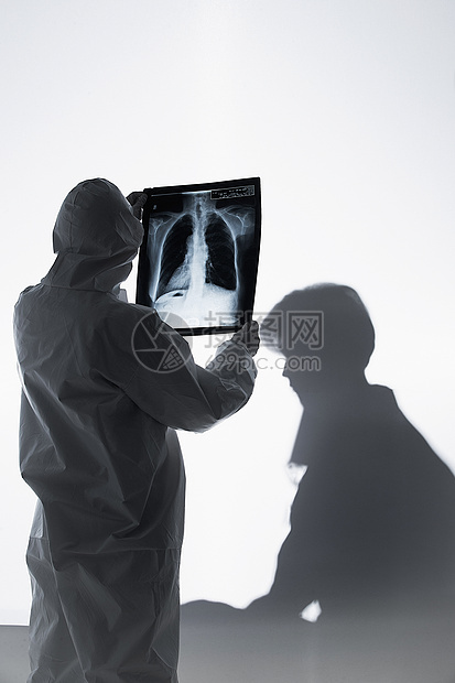 医生给患者看X光片图片