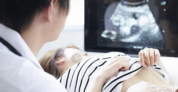妇产科检查的医生听诊器胎儿图片